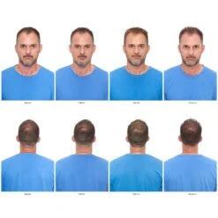 EXT Overnight Rejuvenating Hair Mist -Hairclub Shop EXT Hair Mist Before After 1 2048x2048 f0e6890a 193c 4e16 bd96 b4f18785e25a